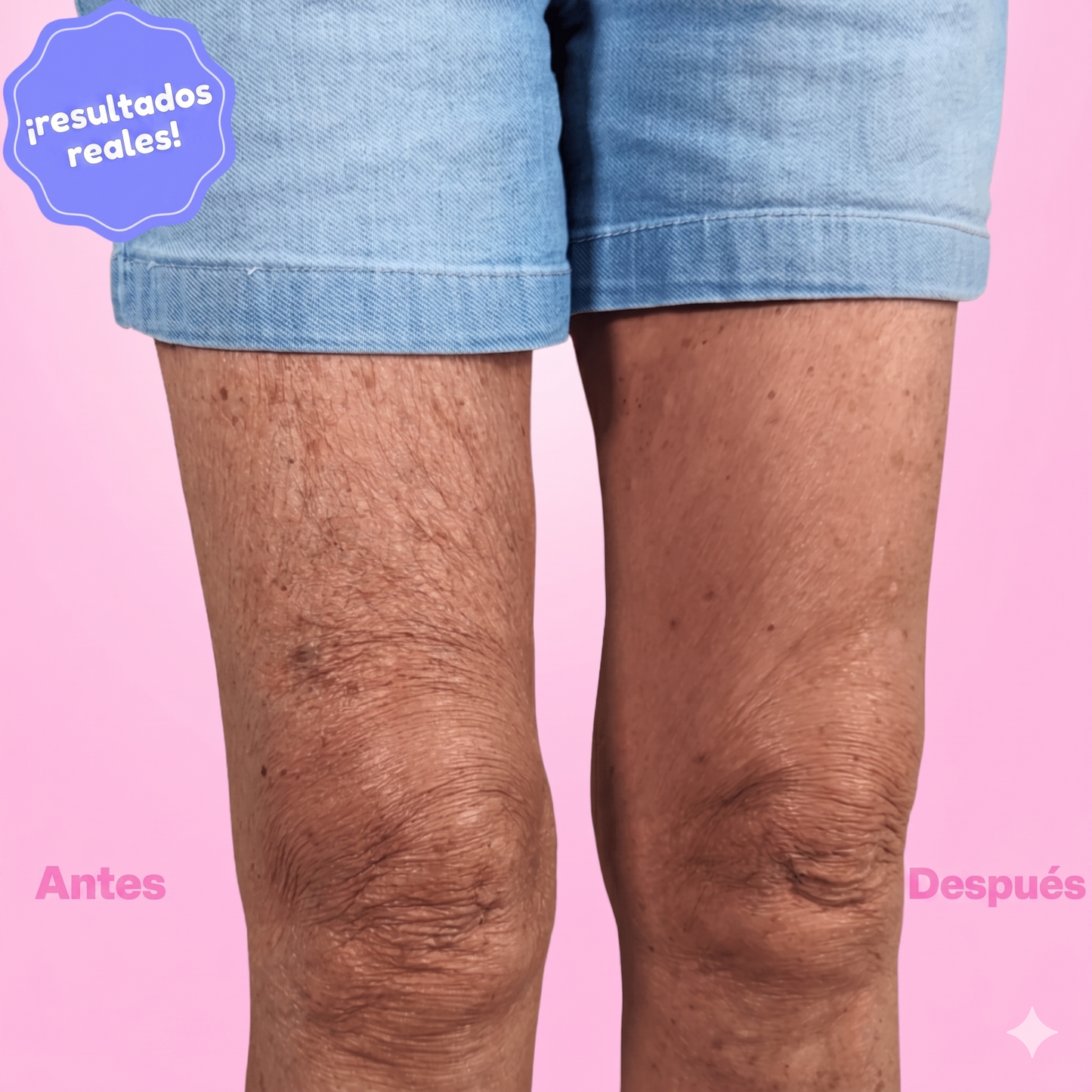 Cinta Invisible Lifting para Brazos, Abdomen, Piernas y Gluteos (Efecto Anticelulitis)