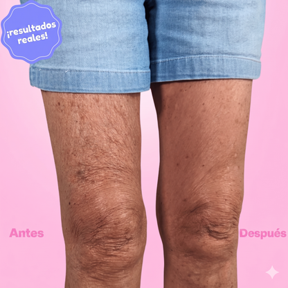 Cinta Invisible Lifting para Brazos, Abdomen, Piernas y Gluteos (Efecto Anticelulitis)