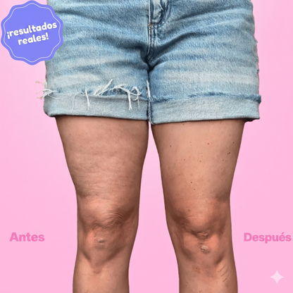 Cinta Invisible Lifting para Brazos, Abdomen, Piernas y Gluteos (Efecto Anticelulitis)